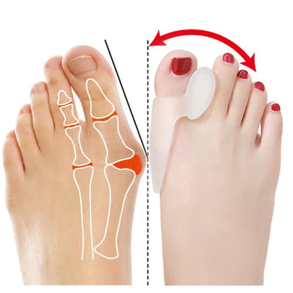 5 Pair Silicone Gel Bunion & Toe Separator Protectors